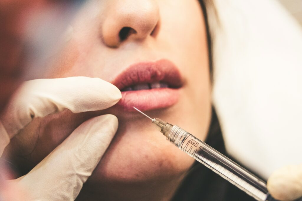 lip filler in 2026